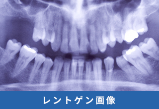 レントゲンのイメージ写真
